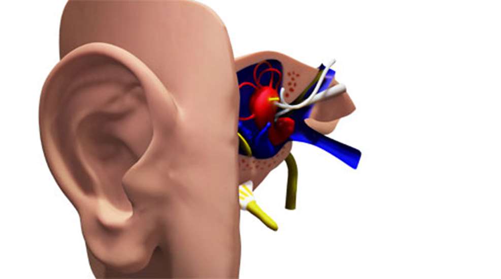 201362085237-ear-render-3_f.jpg