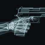 Xray of hand with pistol